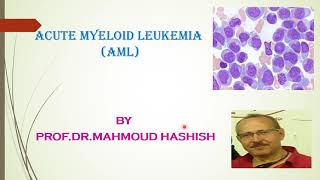 Acute myeloid leukemia part 1 [upl. by Anirret]