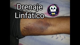 Kinesiotape para Drenaje Linfático Hematomas moretones [upl. by Casavant317]