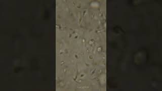 How sperm looks under a microscope shorts [upl. by Akinwahs41]