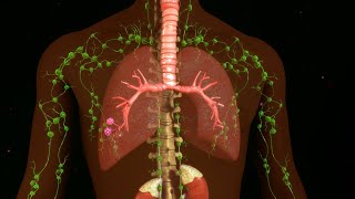 Clinical Charactesistics and Surgical Treatment of Chylothorax [upl. by Drugge886]