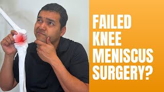 5 Ways To Tell You Might Have A Failed Meniscus Surgery [upl. by Ahsan739]