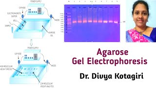 Agarose gel electrophoresis  in detail  Genes amp Genus [upl. by Cardon917]