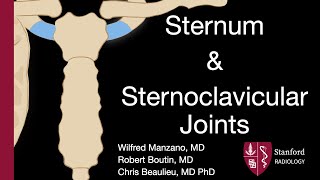 Sternum and Sternoclavicular Joints  Wilfred Manzano MD [upl. by Adahs484]