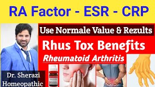 Rhus Tox Homeopathic Medicine Uses Back Pain Treatment  Dr Sherazi Homeopathic [upl. by Iver]