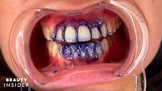 Purple Teeth Stains Can Temporarily Brighten Yellow Stains  Beauty Insider [upl. by Varrian]