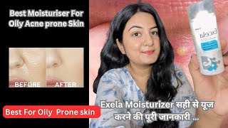 Cipla Excela Moisturiser Review  Dermatologist Recommended Moisturiser For OilyAcne Prone skin 😱✨ [upl. by Arabela]