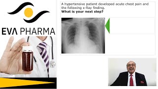 cme internalmedicine Medicine usmle Hypertension  Acute Chest Pain Answer محاضراتباطنة [upl. by Schulein]