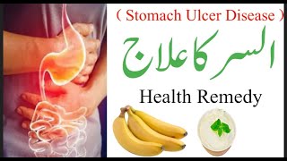 Ulsar ka Ilaj  Ulsar Disease  Home Remedy  Ulsar Treatment UrduHi di [upl. by Nais857]