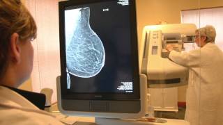 ZP Rad  What is Breast Tomosynthesis [upl. by Ahcire]