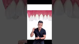 Delhi Dentist Reveals SHOCKING Tooth Loss Effects [upl. by Myrt763]