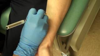 Allergy Testing Step 1 Skin Prick Testing [upl. by Ernestus]