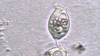 Vorticella infusionumcomplex in activated sludge [upl. by Cochran949]