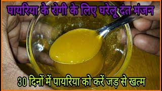 30 दिनों में करिए पायरिया रोग को जड़ से खत्म  Pyorrhea Treatment At Home  Pyorrhea Home Remedies [upl. by Elianore826]