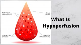 What Is Hypoperfusion [upl. by Salomone]