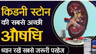 पथरी की सबसे अच्छी होम्योपैथिक दवा  Kidney stone homeopathic medicine  सबसे जरूरी परहेज🧑‍⚕️ [upl. by Sadowski]