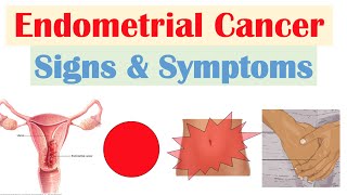 Endometrial Cancer Signs amp Symptoms amp Why They Occur [upl. by Baxy349]