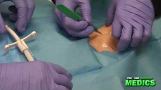 Surgical Cricothyrotomy by the Paramedic Intern [upl. by Maurreen606]