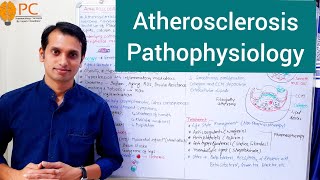 Atherosclerosis Pathophysiology  Etiology and Pathogenesis of Atherosclerosis [upl. by Lonna]