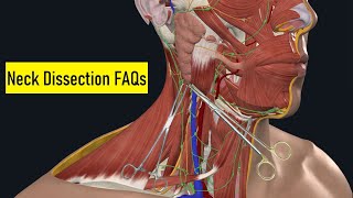 Levels of lymphnodes in the neck and palpation of cervical lymph nodes [upl. by Mikes747]