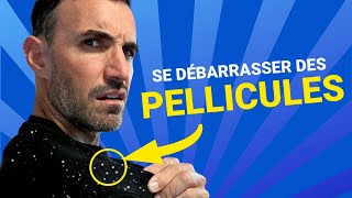 Comment se débarrasser efficacement des Pellicules [upl. by Ailatan]