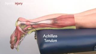 Achilles Tendonitis  Tendinopathy  Explained in 90 Seconds [upl. by Diena]