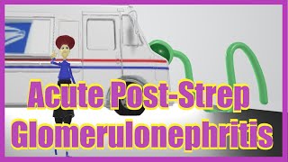 Acute PostStreptococcal Glomerulonephritis Mnemonic for the USMLE [upl. by Rimma835]