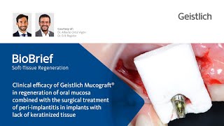 Clinical case Efficacy of Geistlich Mucograft® for lack of keratinized tissue and periimplantitis [upl. by Jeremy807]