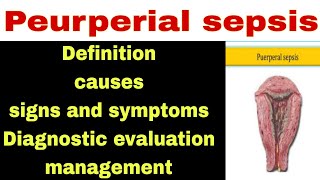 peurperial sepsis Introduction Causes  Signs and Symptoms DE  management [upl. by Gothar]