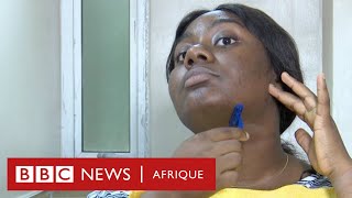 Chidube une femme qui souffre dhirsutisme et qui encourage les autres sur les réseaux sociaux [upl. by Virgy]