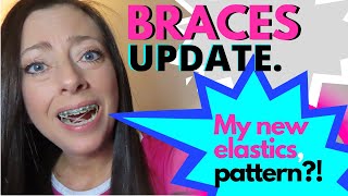 BRACES UPDATE  MY NEW ELASTICS PATTERN  HOW TO PUT ON ELASTICS FOR BRACES  DONNELLE GRIFFIN [upl. by Antonius]