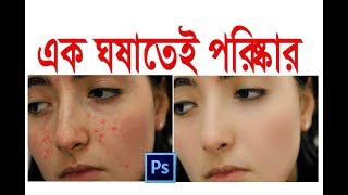 কিভাবে ছবি সুন্দর করা যায় How to Skin Retouching in Photoshop [upl. by Laks]