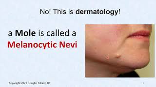 Dermatology Congenital and Acquired Melanocytic Nevi Moles [upl. by Margret]