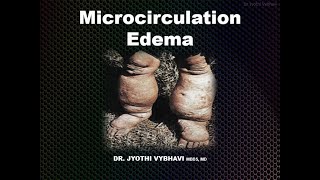 Microcirculation  Edema [upl. by Mou50]