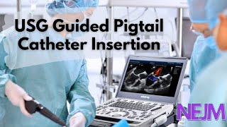 Ultrasound Guided Pleural Pigtail Catheter Placement Tutorial  NEJM  EDAIC  DNB  MD [upl. by Marcos]