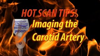 Hot Tip  Imaging The Carotid Artery [upl. by Neras]