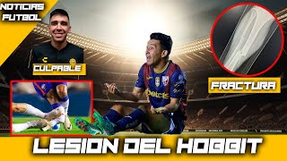 TERRIBLE entrada sobre el Hobbit Bermúdez del Atlante en Liga de Expansión [upl. by Ynots944]