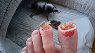 these bugs can eat toes [upl. by Leahsim411]