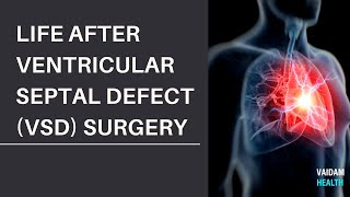 Life after Ventricular Septal Defect VSD Surgery [upl. by Eenhpad816]