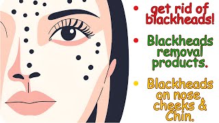 The ultimate guide to removing blackheads [upl. by Adnir532]