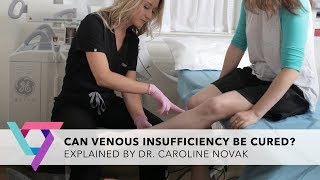 Medical Clinic Can Venous Insufficiency Be Cured  Vein Treatment Clinic New York 10016 [upl. by Eidahs]