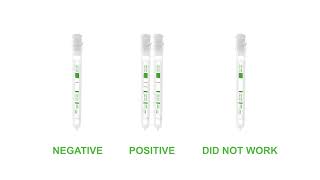 The BioSURE COVID19 IgG Antibody Self Test – USER VIDEO [upl. by Anialed]