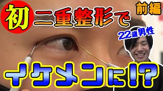 【イケメン変身企画】前髪でなるべく隠していた一重。二重整形ではたして男性はイケメンになれたのか？埋没二重二重にする方法【湘南美容クリニック】 [upl. by Lonnard259]