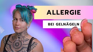 ALLERGIE bei Gelnägeln  Das kannst Du tun [upl. by Oelak]