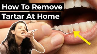 Is it Possible To Remove Tartar At Home [upl. by Vlad987]