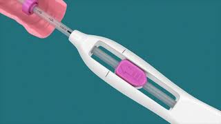 IUD Insertion Video [upl. by Dream597]