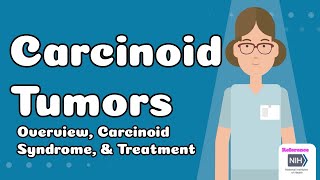 Carcinoid Tumors  Overview Carcinoid Syndrome amp Treatment [upl. by Alyworth]