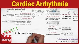 Pharmacology  Cardiac Arrhythmia and Antiarrhythmic Drugs FROM A TO Z [upl. by Bouton]