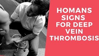 Homans Sign for Deep Vein Thrombosis [upl. by Naget495]