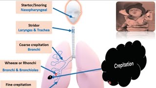 Respiratory System Examination in Newborn I Newborn Examination PART 6  Pediatrics [upl. by Aerdnu394]