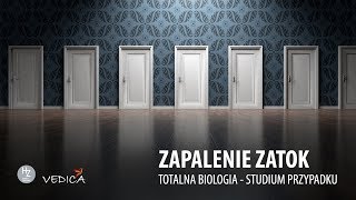 ZAPALENIA ZATOK  Totalna Biologia  Studium przypadku [upl. by Anesusa]